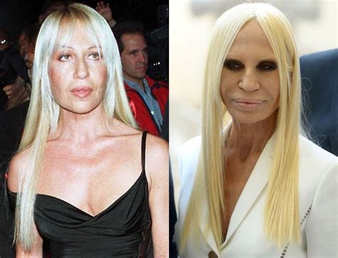 donatella versace wikipedia|donatella versace before and after surgery.